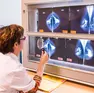 25 Nov 2013 --- Doctor examining mammographies, Angoulême hospital, France . --- Image by BURGER/PHANIE/phanie/Phanie Sarl/Corbis (b. 63) Immagine 42-72503453.jpg da ireope host GRR7 @autore BURGER/PHANIE/phanie/Phanie Sa