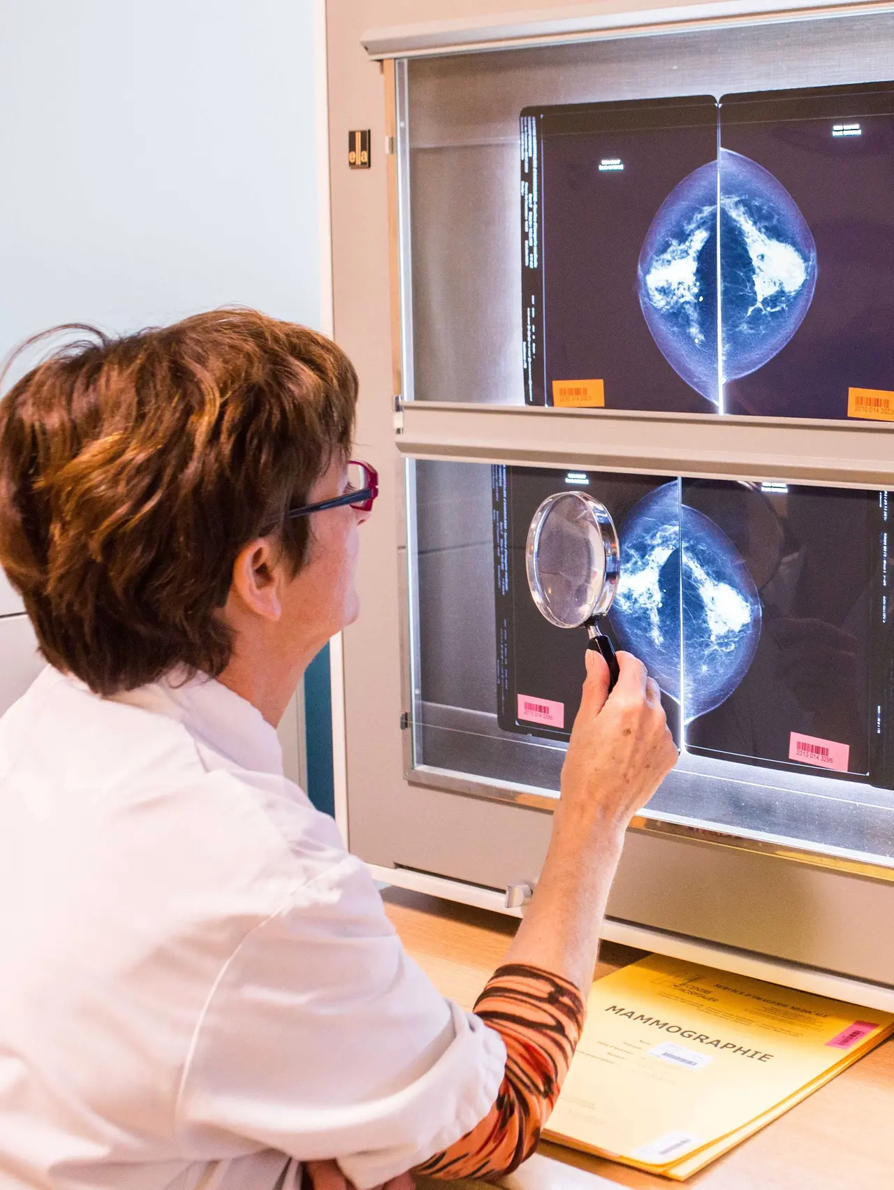 25 Nov 2013 --- Doctor examining mammographies, Angoulême hospital, France . --- Image by BURGER/PHANIE/phanie/Phanie Sarl/Corbis (b. 63) Immagine 42-72503453.jpg da ireope host GRR7 @autore BURGER/PHANIE/phanie/Phanie Sa