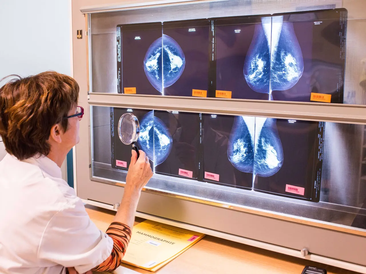 25 Nov 2013 --- Doctor examining mammographies, Angoulême hospital, France . --- Image by BURGER/PHANIE/phanie/Phanie Sarl/Corbis (b. 63) Immagine 42-72503453.jpg da ireope host GRR7 @autore BURGER/PHANIE/phanie/Phanie Sa