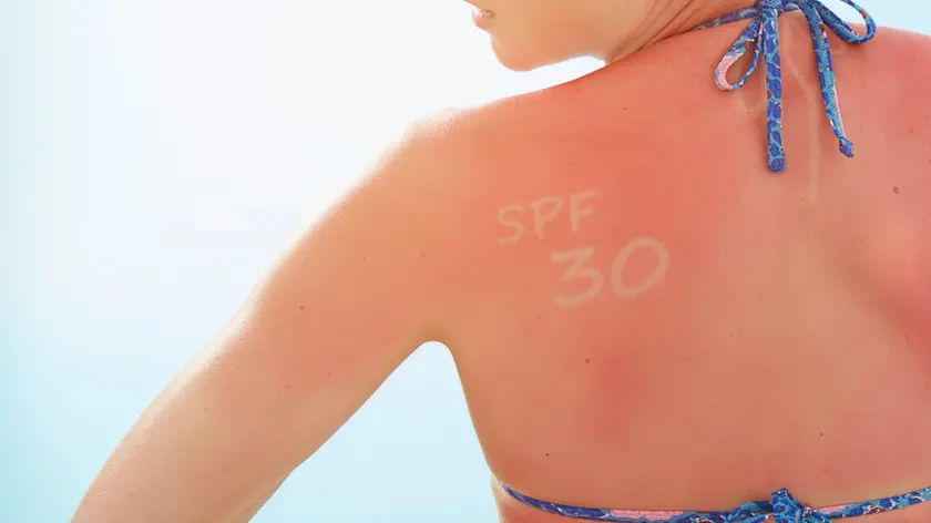 La sfida social dell'estate è la super abbronzatura ma occhio ai rischi