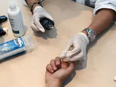 Nuovo metodo con intelligenza artificiale per scoprire precocemente il rischio di diabete di tipo 2