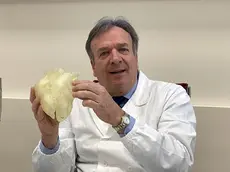 Il professor Gino Gerosa dell'Azienda Ospedale Università di Padova