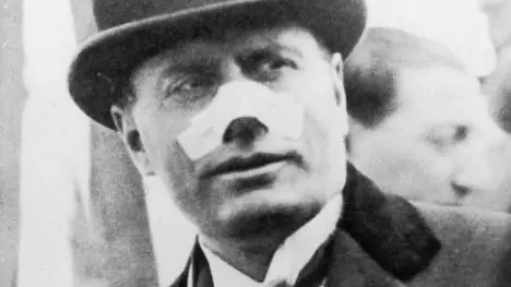 Benito Mussolini dopo l’attentato Gibson