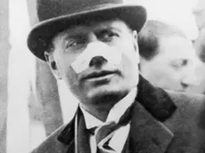 Benito Mussolini dopo l’attentato Gibson