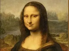 La Gioconda: si intravede nell’angolo interno dell’occhio sinistro un deposito di tessuto adiposo