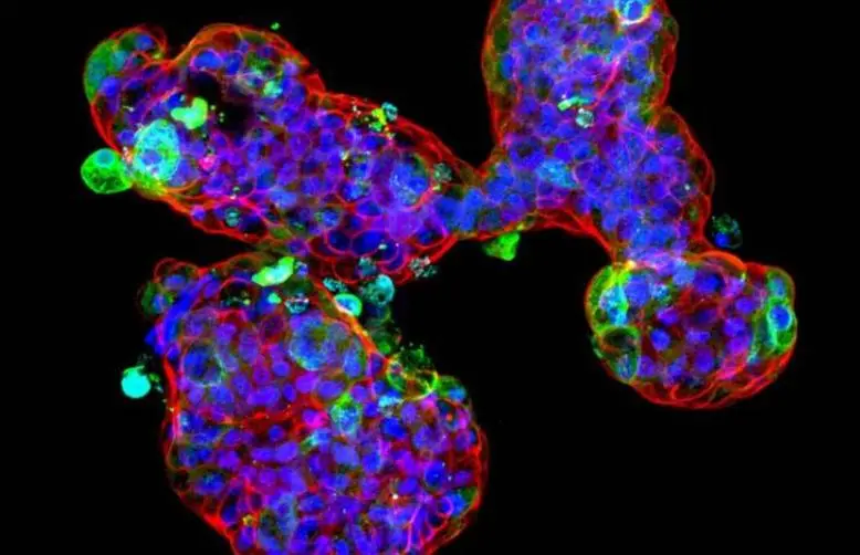 Il modello dello stomaco in vitro