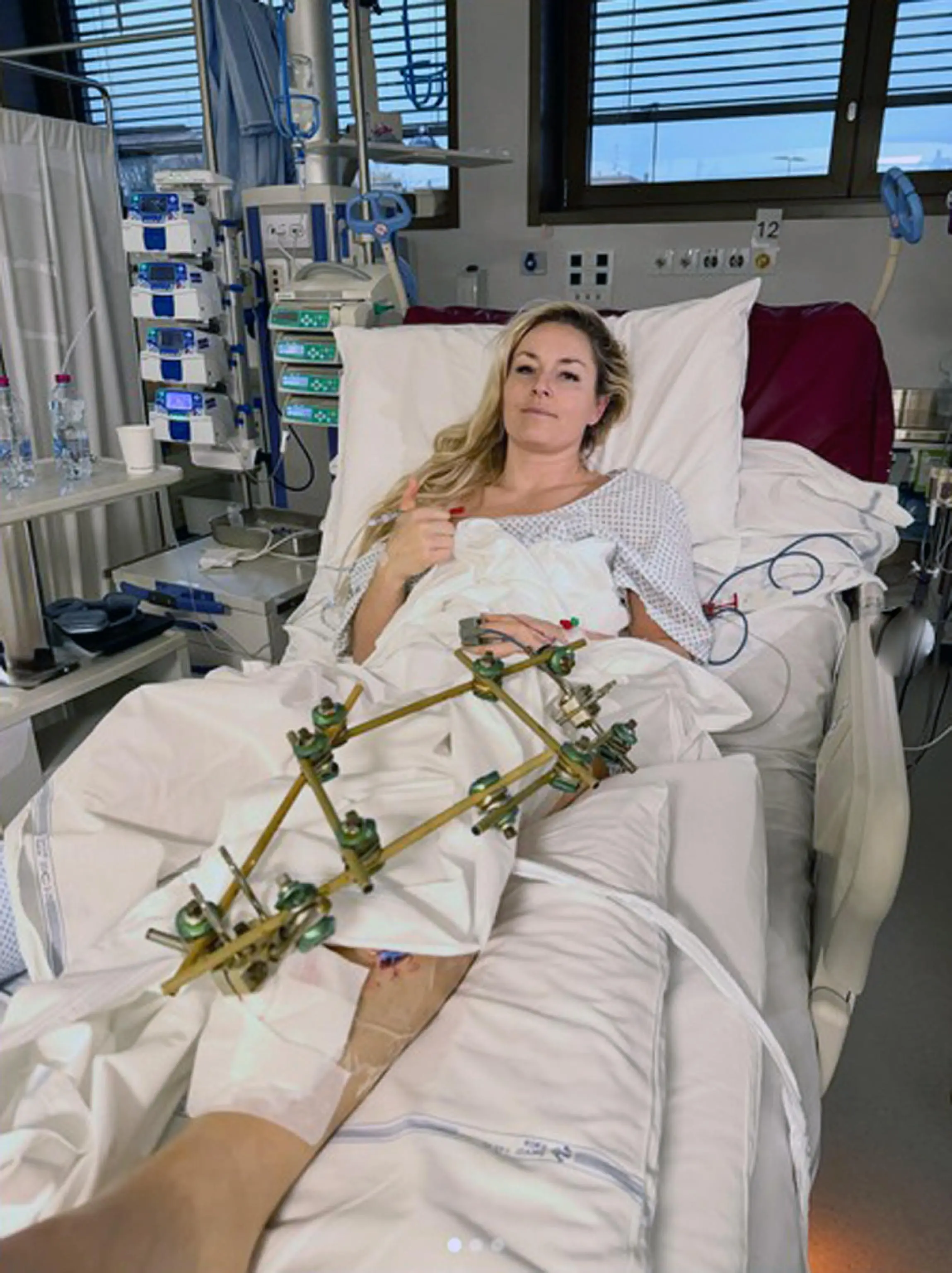 Lindsey Vonn, ricoverata all'ospedale Ca' Foncello di Treviso, dopo la caduta nella discesa libera