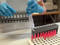 Provette per le analisi di laboratorio in una foto di archivio