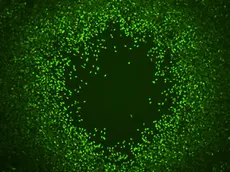 Delle spore batteriche fotografate con il microscopio