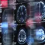 Le immagini della risonanza magnetica di un cervello