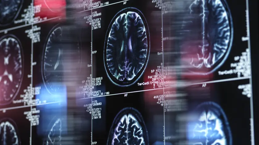 Le immagini della risonanza magnetica di un cervello
