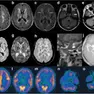 Immagini di un cervello