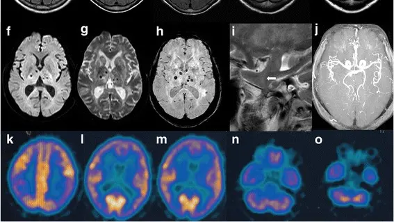Immagini di un cervello