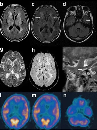 Immagini di un cervello