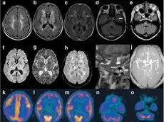 Immagini di un cervello