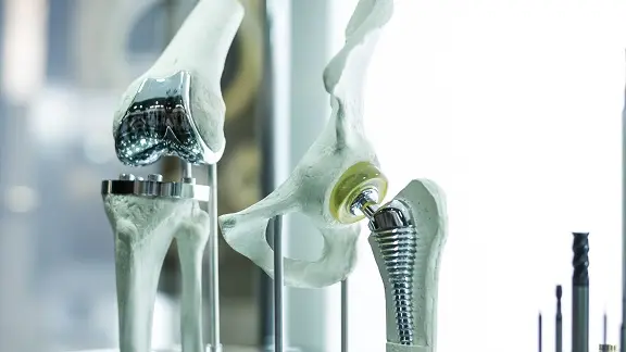 Modern knee and hip prosthesis made by cad engineer and manufactured by 3d printing